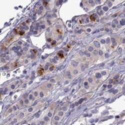 COL22A1 Antibody, Novus Biologicals:Antibodies:Primary Antibodies
